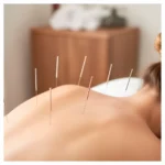 Agujas De Acupuntura Para Alivio Muscular C&D® (1 Caja 100 Unid.)