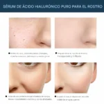 Hilos Tensores de Colageno Sin Agujas Efecto Lifting 1 Paq. 12 Unid.