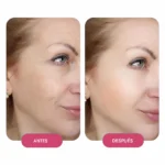 Viales de 7ml para Dermapen Sanendi® (1 Caja 3 Unid)