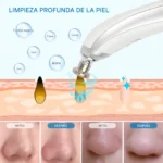 Extractor Punta de Diamante Portátil Facial (1 Set Completo)